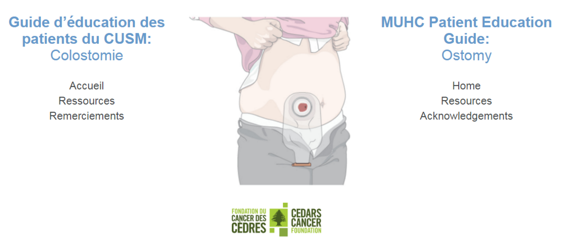 Guide d'éducation des patients du CUSM: Colostomie