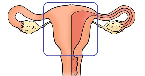 Hystérectomie abdominale totale