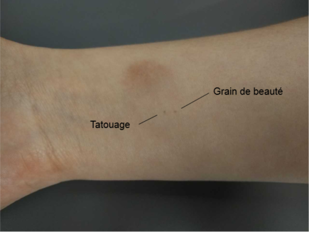 Tatouage