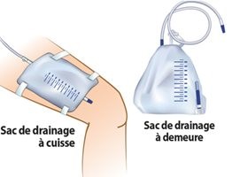 Sacs de drainage